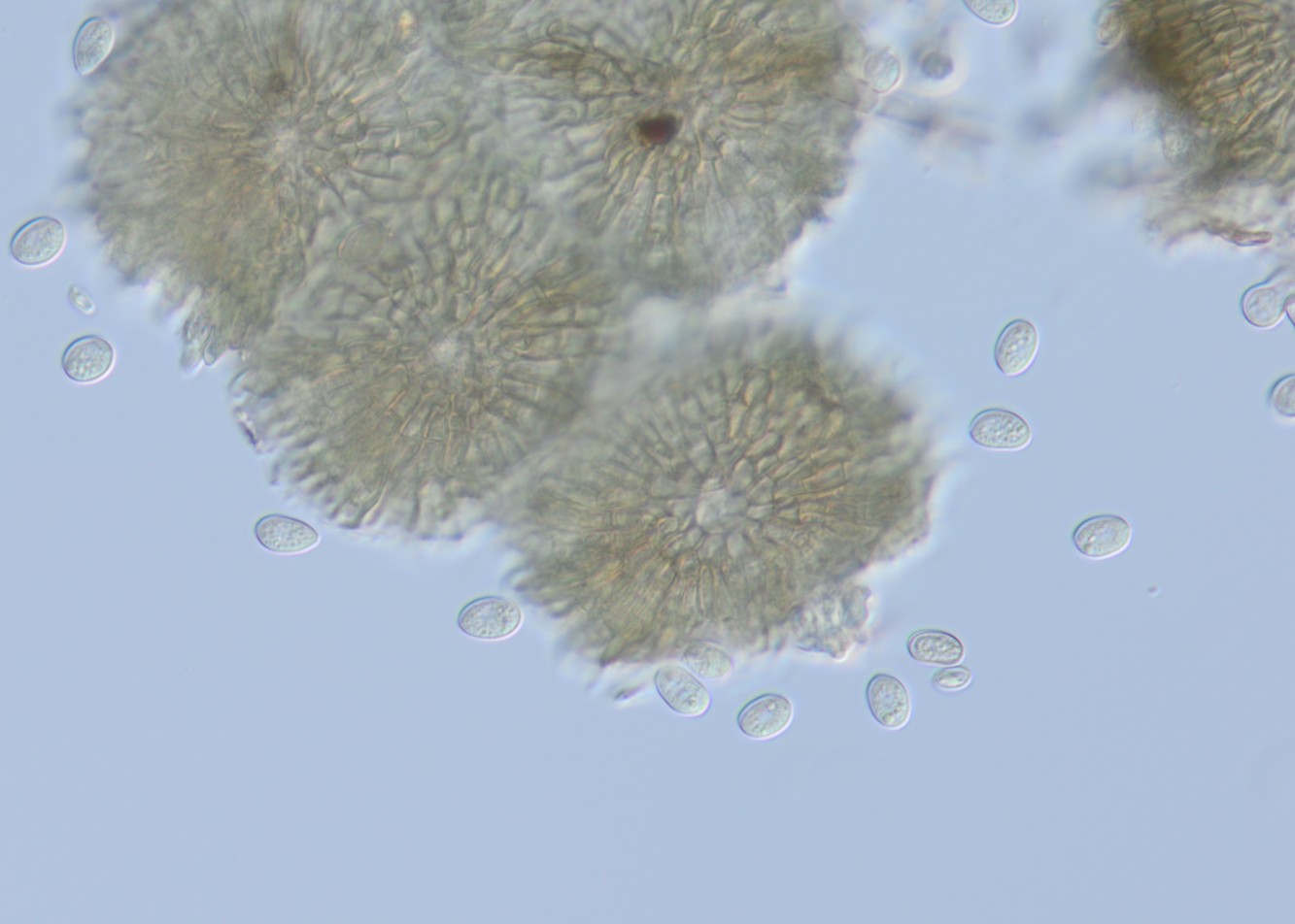 202103226 Tubakia sp. burr oak 3.jpg